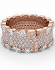 Y | 100% Rose Band